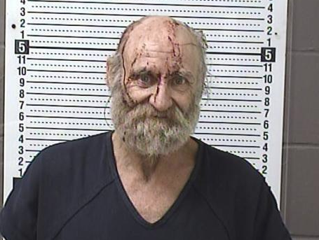 The visible injuries in Mitchell's booking photo were sustained prior to officers arrival at the home, according to police.