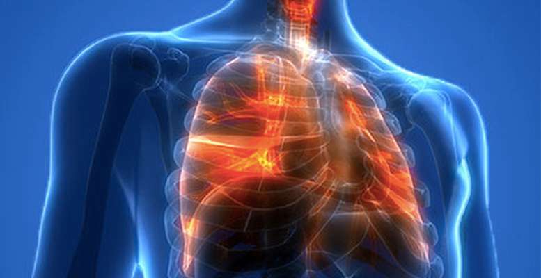 CDC, the U.S. Food and Drug Administration, state and local health departments, and other clinical and public health partners are investigating a multistate outbreak of lung injury associated with e-cigarette product use, or vaping. Graphic courtesy of the CDC