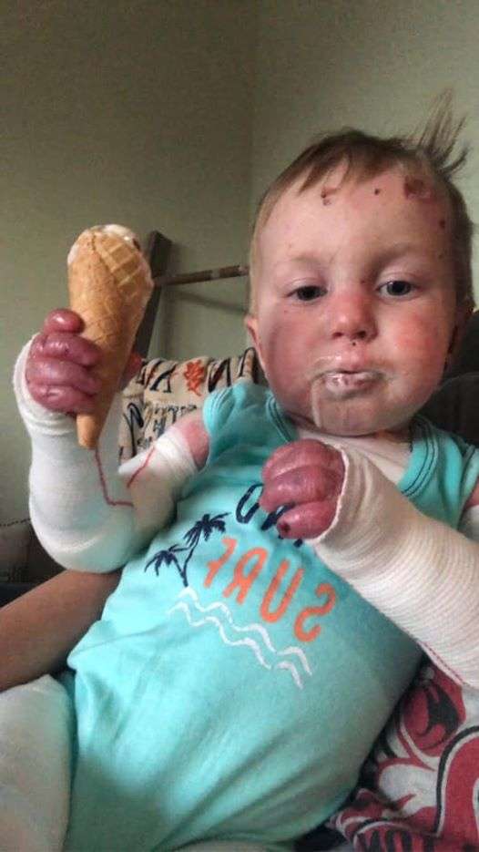 Kelton Wolf eats an ice cream cone. Some children with Kelton's disorder can't eat or talk because of sores or scars in their mouths. Courtesy photo