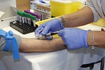 Barton Co. Health Dept. offers 'lab fair' prices on blood tests