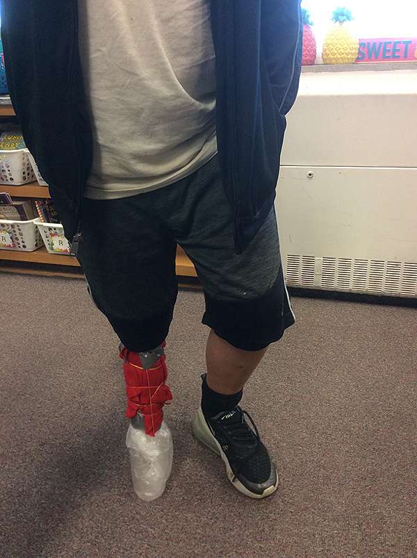 Monia Dreiling's fifth-grade students designed prosthetics as part of a science project. Courtesy photo<br>