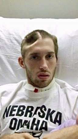 Chase Kear in a hospital bed following his pole vault accident with part of his skull and brain removed. Courtesy photo