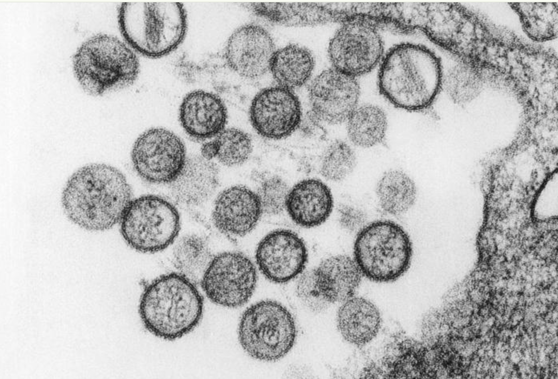 Transmission electron microscopic image of spherical Sin Nombre virus particles shows a distinct viral envelope with short surface projections, and the internal nucleocapsid. A species of the genus Hantavirus, the Sin Nombre virus is the cause of hantavirus pulmonary syndrome (HPS) in humans.