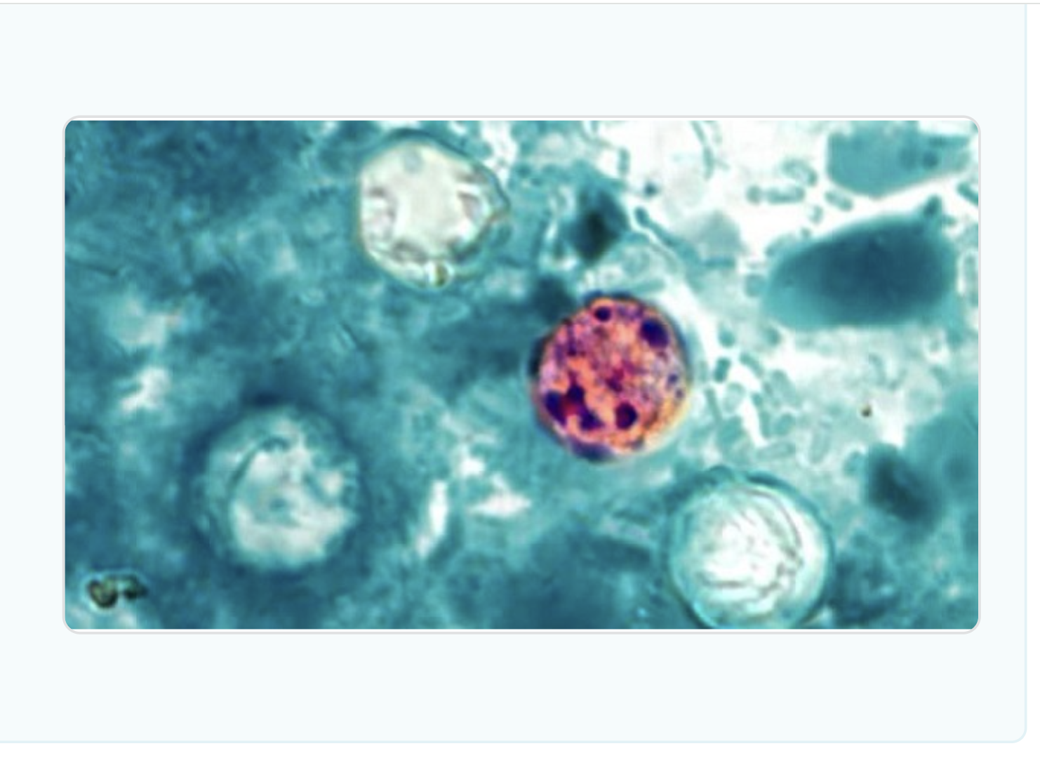 CDC image