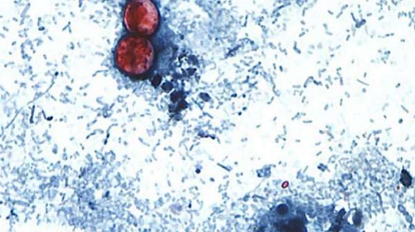 The parasite Cyclospora cayetanensis. KDHE image